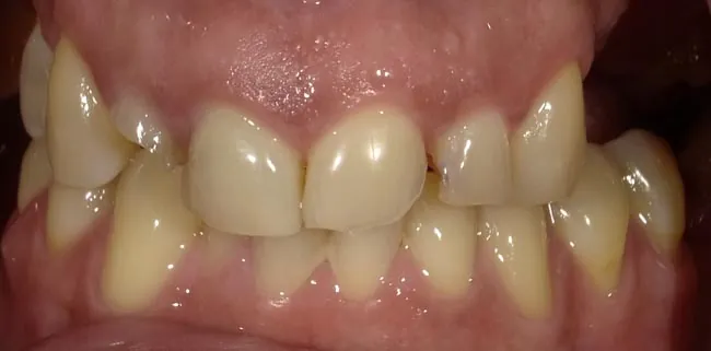 Before image