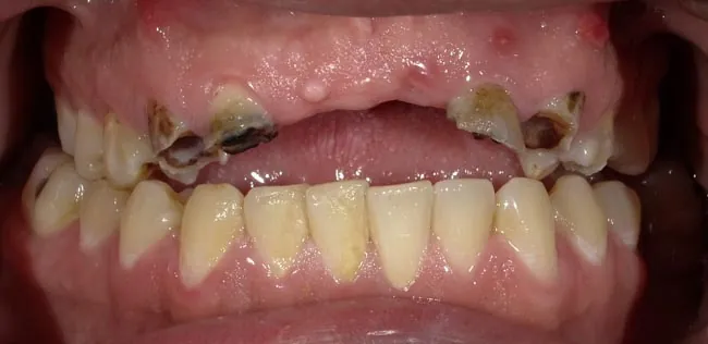 Before image