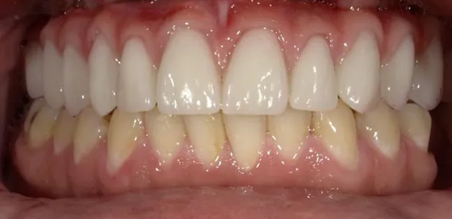 After image