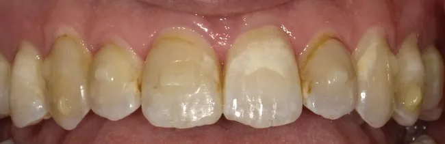 Before image