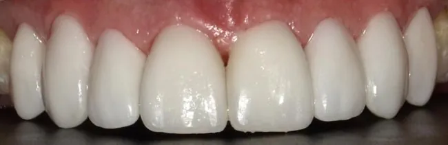 After image