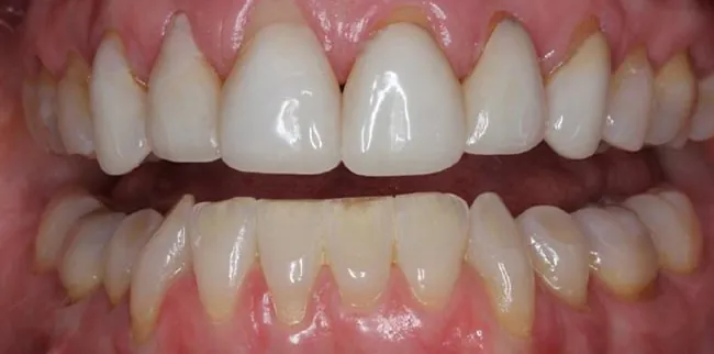 Before image