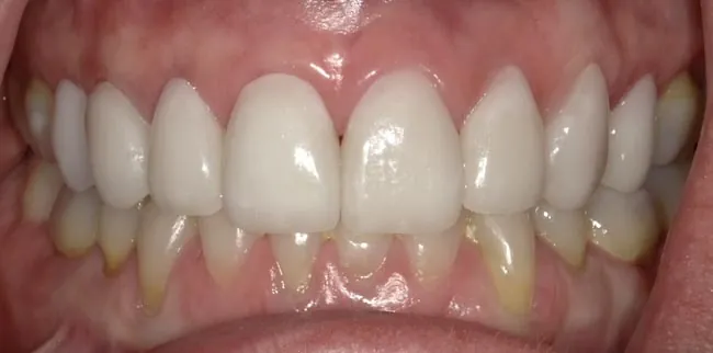 After image