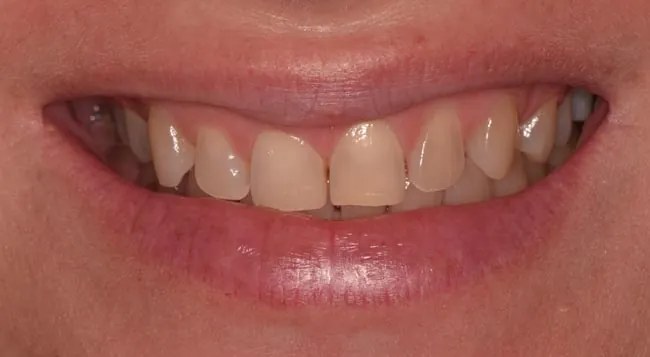 Before image