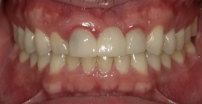Before image