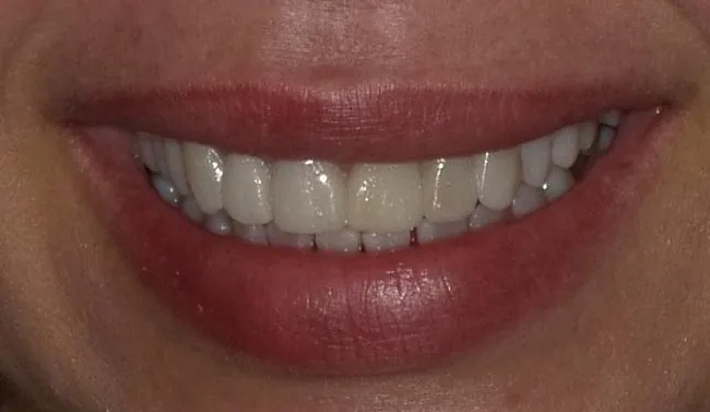 After image