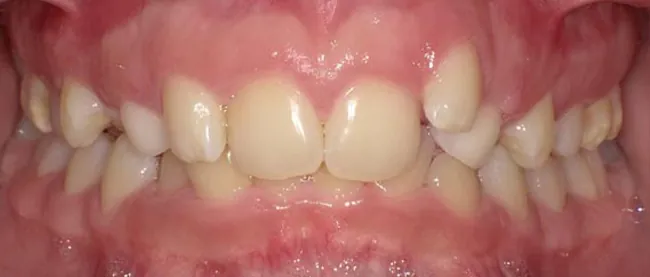 Before image