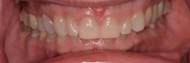 Before image