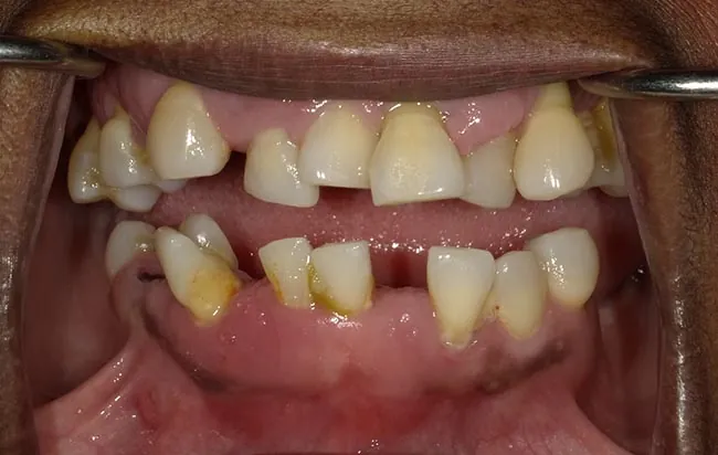 Before image