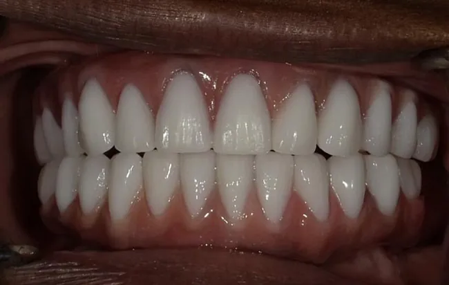 After image
