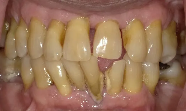 Before image
