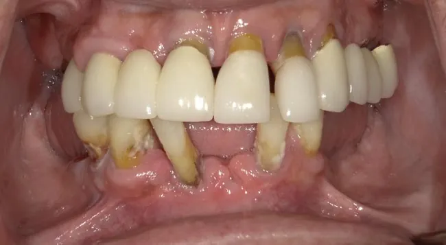 Before image