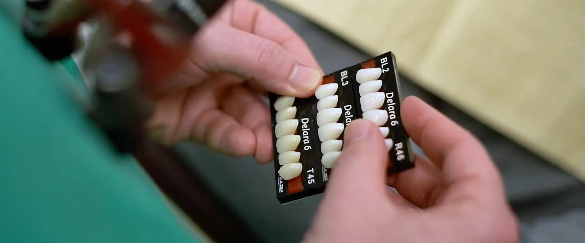 Dr. Oliveira holding a dental veneer color-match diagram