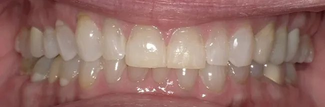After image