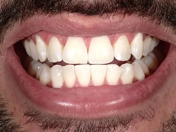 After image