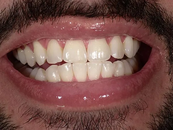 Before image