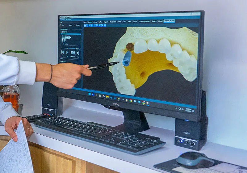 3D technology used to map out dental restorations